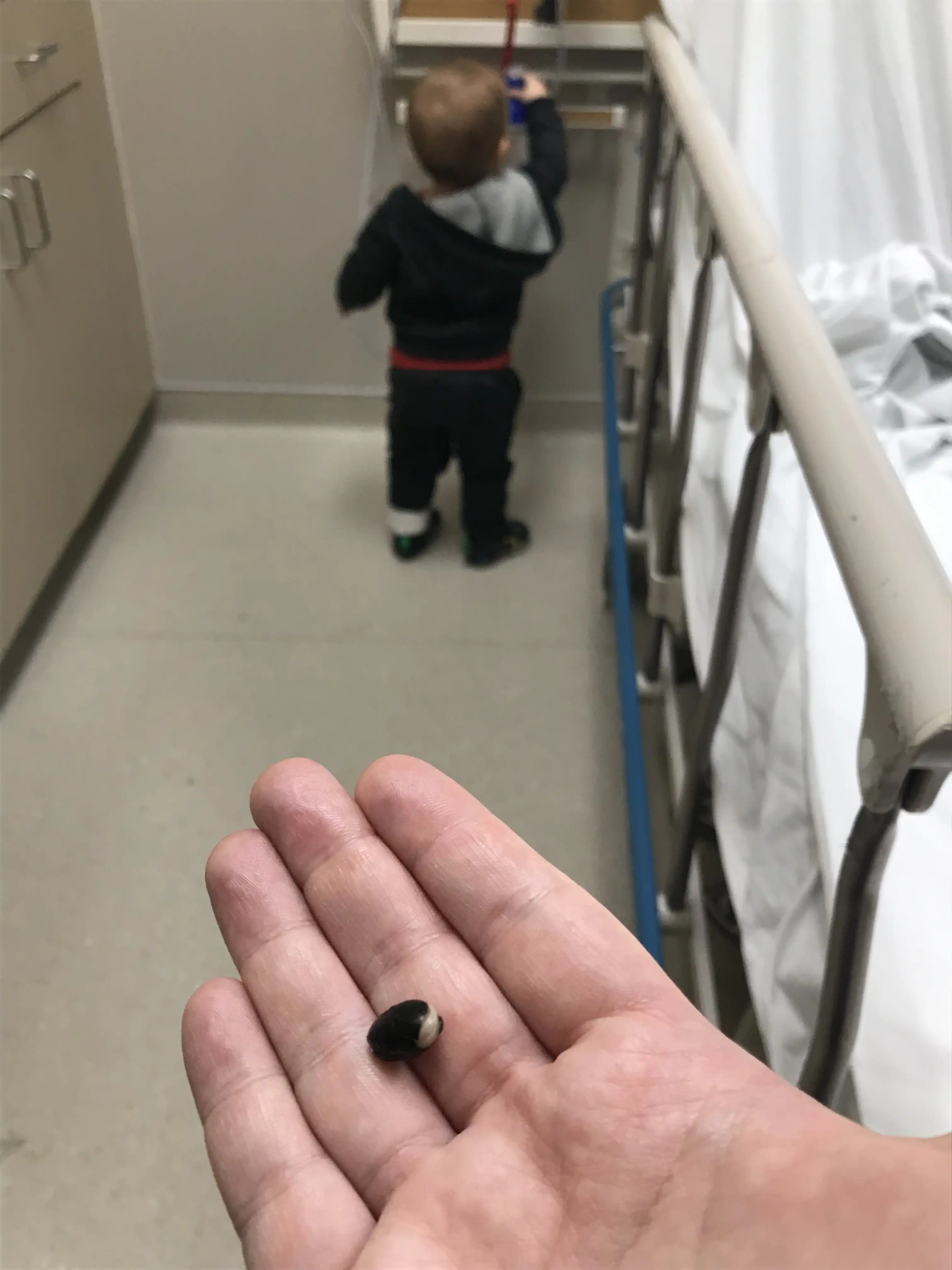 The black bean from Royal's nose in Amie's hand.