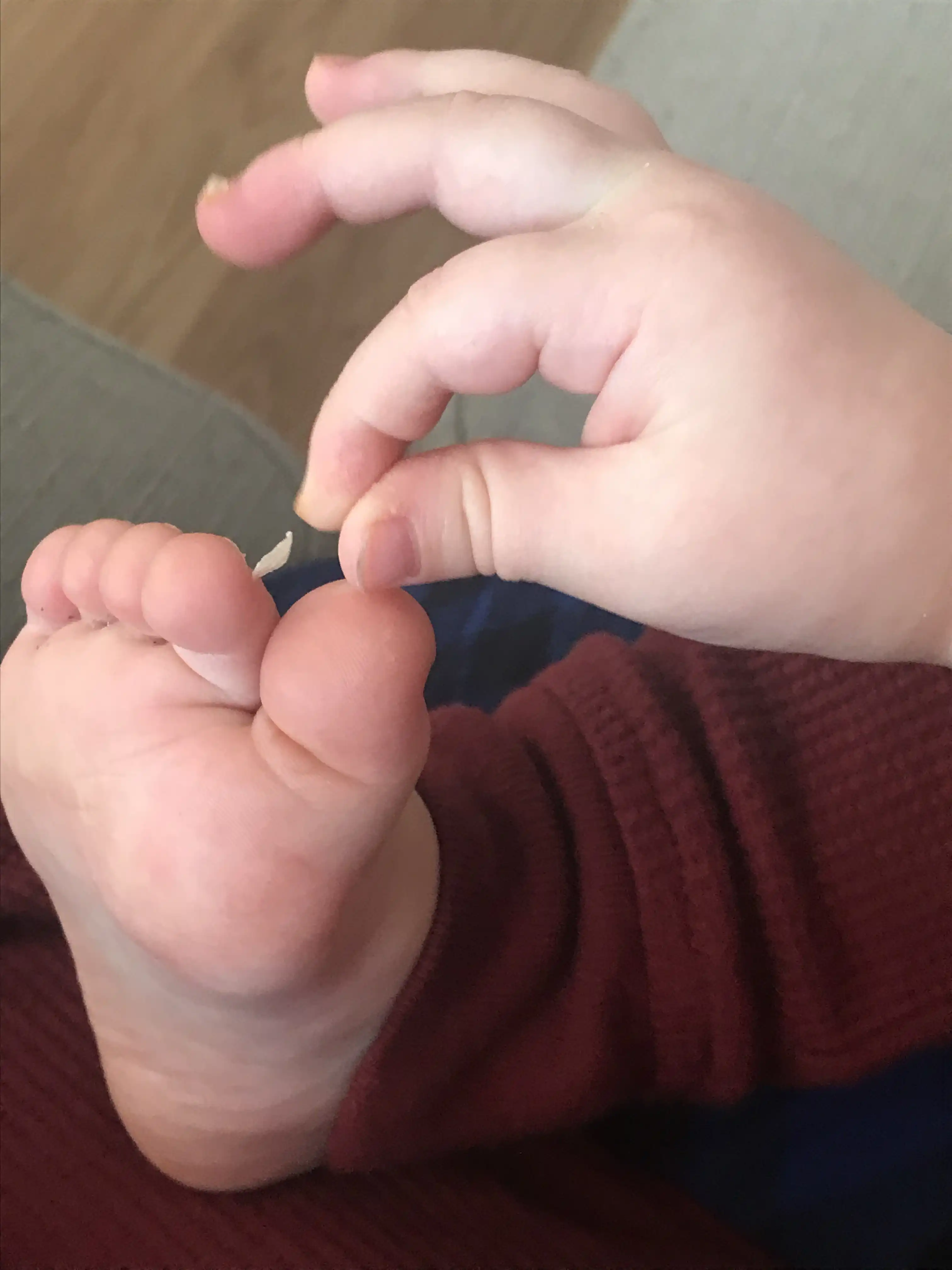 Royal pulling his toenail off.