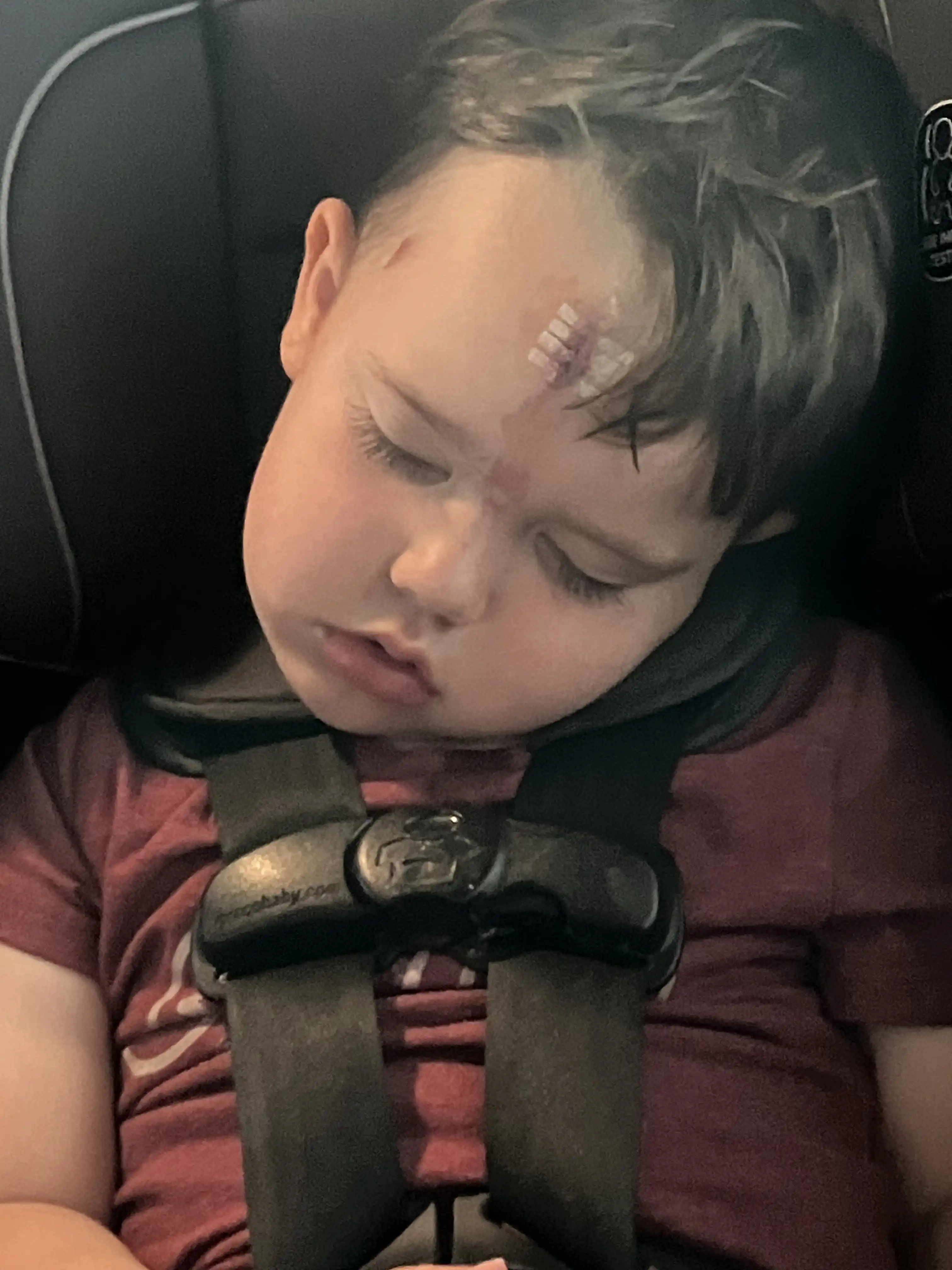 Royal asleep in his carseat with a bandage on his forehead between his eyes.