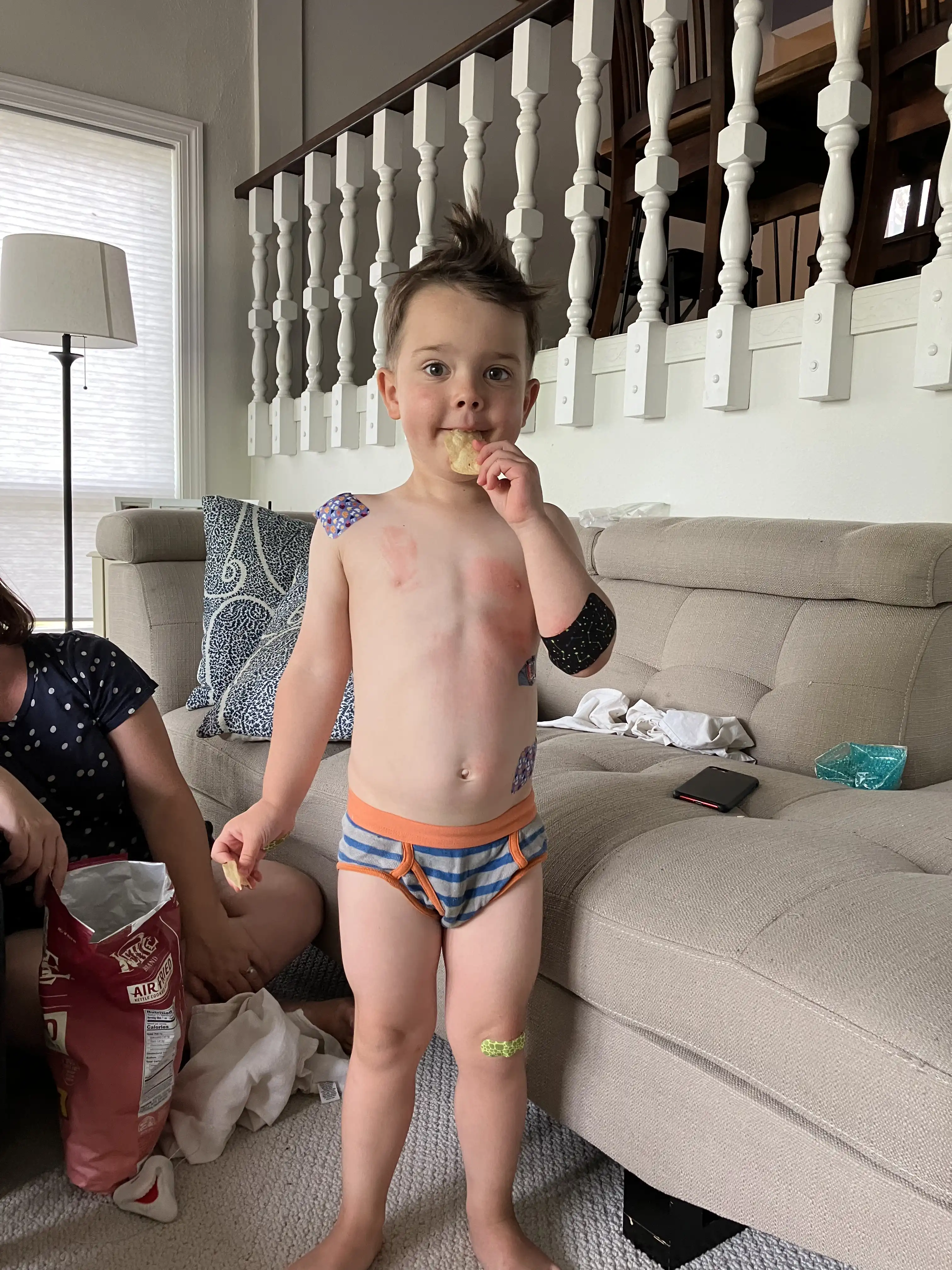 Royal in the living room showing off his scrapes and bandages.